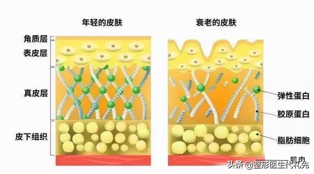 微创面部提升术有危险吗（做过微创小切口面部提升的人才知道的10件事）(2)