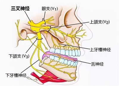 ​三叉神经痛吃什么药好得快（别再吃止痛药了，副作用大还没效果，三叉神经痛药