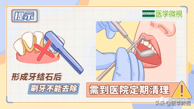 ​去牙医院洗牙多少钱 到牙科洗牙要多少钱